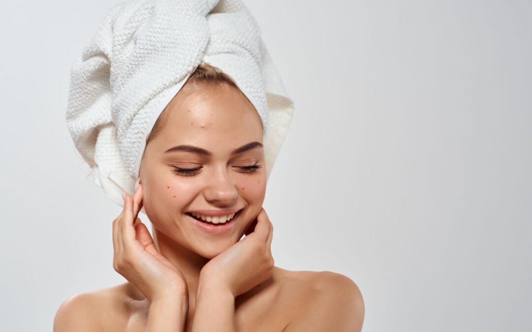 Woda morska a&nbsp;trądzik u&nbsp;kobiet i&nbsp;nastolatek